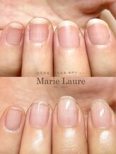 マリーロール 梅田店(Marie Laure)/自爪育成/深爪矯正/ネイルケア
