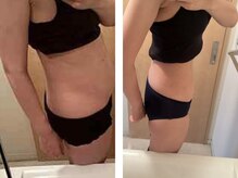 ヨサパーク ナナラーレア 福島店(YOSA PARK nanala lea)/痩身/ダイエット/リンパ/水素