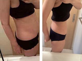 ヨサパーク ナナラーレア 福島店(YOSA PARK nanala lea)/痩身/ダイエット/リンパ/水素