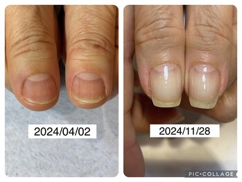 アンドネイル 海老名(&nail)/半年で？！