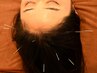 【期間限定】時間内オプション《頭皮鍼1000円OFF♪》で睡眠の質UP！
