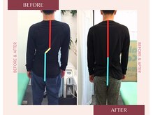 浦安駅前鍼灸整体院/before＆after