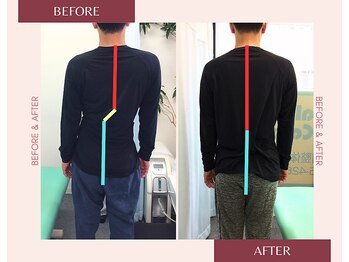 浦安駅前鍼灸整体院/before&after