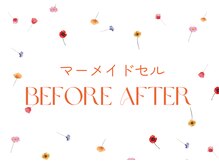 カイト(Kaito)/マーメイドセルトリートメント