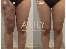 アリリィ(ARILY)/ARILY after care salon