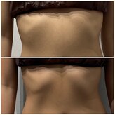 アーヒル(A”-HILU)