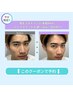 《再来/学割U24/人気No3》美眉WAX+毛量調整(間引き/カット)×選択フェイスWAX