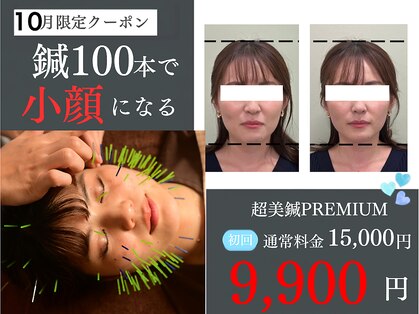 マーキュリー(Mercury)の写真