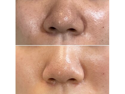 エレナ(ERENA)の写真