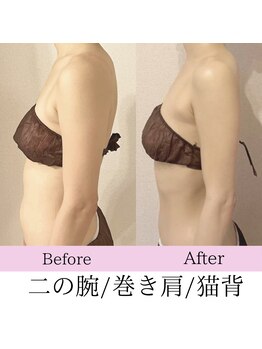 ピーチハート(Peach Heart)/黄金比小顔全身コルギ