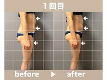 メゾン ド クロエ(Maison de Chloe)/CHLOE式パーソナル痩身