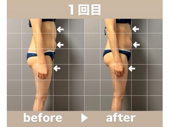 メゾン ド クロエ(Maison de Chloe)/CHLOE式パーソナル痩身