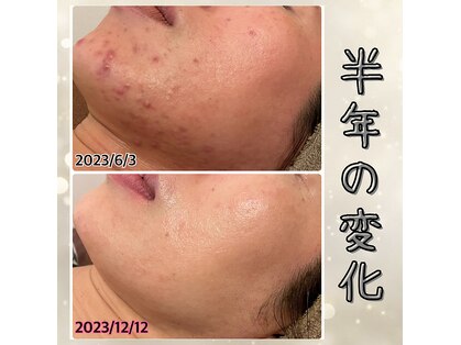 プルーム 久留米店(plume)の写真