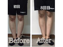 椿 三宮院の雰囲気（姿勢不良からくるO脚や肩こり、腰痛などもお任せください♪）