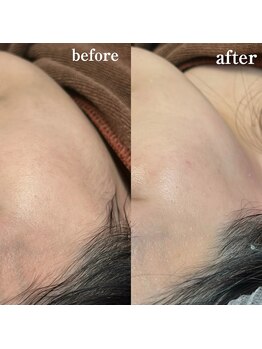 ブリリアント(brilliant)/フェイシャルワックス