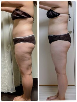 ヨサパーク モックス 堺東(YOSA PARK MOX)/30代前半　ルルオン2週間で6回