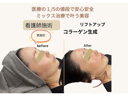 ウェルネス(wellness)の写真