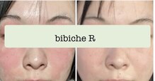 ビビッシュアール(bibiche R)