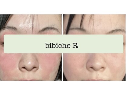 ビビッシュアール(bibiche R)の写真
