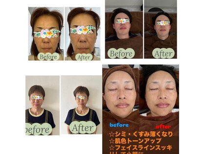 ベルファム(Belle femme)の写真