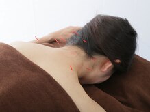 げんき堂整骨院/げんき堂鍼灸院 ららぽーと海老名/体の状態に合わせた施術☆