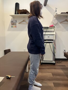 整骨院葵堂 焼津院/アフター写真です!