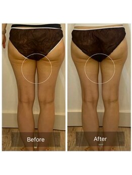 ウィズ ユー ビューティ(with U beauty)/肉感減って小尻に