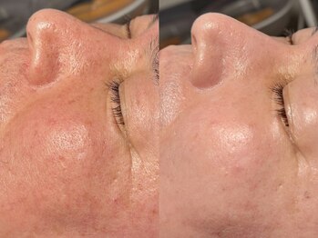 ルーナジェーナ(Luna llena)/