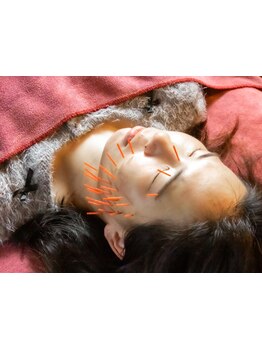 鍼灸施術を受けたい