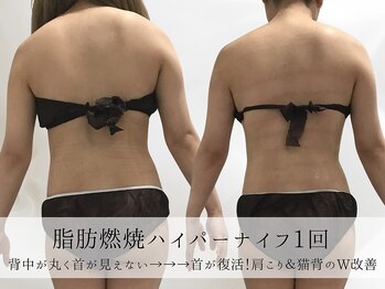 ミヨンラボ(miyon LABO)/脂肪燃焼ハイパー1回!