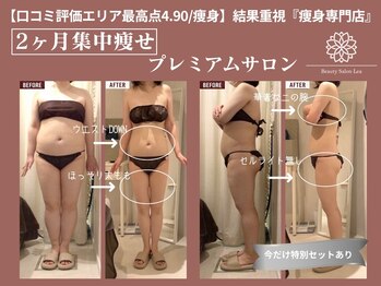 上野エステサロン レア(Lea)