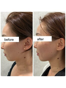 ワンダーウォール 福岡城南店(WONDER WALL)/RED SHOT