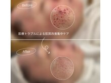 ハニー(Honey)の雰囲気（＼技術に自信あり／フェイシャル美肌、肌質改善、大人にニキビ）