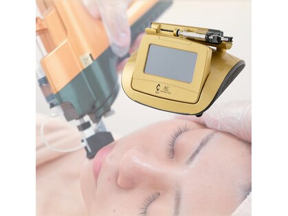 キアラ(Chiala)の写真