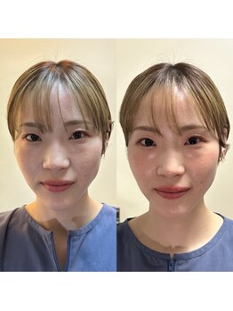 養美ラボ(YOBI Labo)/ビフォーアフター
