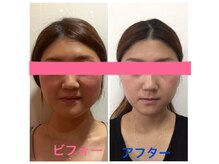 サロンドホープの雰囲気（エラスッキリVラインフェイスにくすみも取れて美肌に◎）