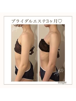 マージェ(magie)/ブライダルエステ