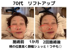 エンジェルエッグ/◆全体的にスッキリ引き締まり