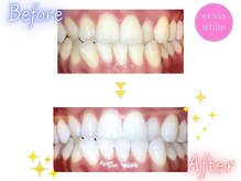 エクシアホワイト 新宿御苑店(ecxia white)