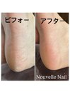 足裏角質ケア