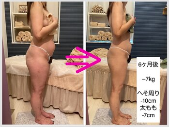 ヴィオラ(Viola)/痩身のお客様