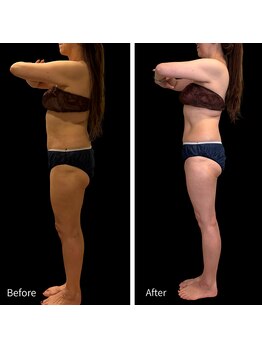 クールヴィラ(Cool Villa)/