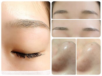 トータルビューティ ノイド(Noid)/小鼻コース+美眉毛WAX脱毛