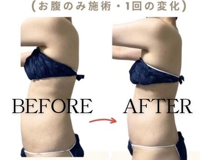 ネオボディ(Neo Body)の写真