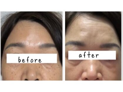 サロン リノ(salon rino)の写真