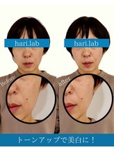 ハリラボ(hari Lab.)/【お客様の声】