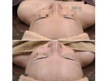 シス(SiS.)/ハーブでツヤツヤ透明肌