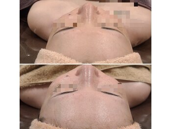 シス(SiS.)/ハーブでツヤツヤ透明肌