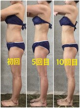 アクアカイロプラクティック/痩身☆