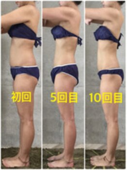 アクアカイロプラクティック/痩身☆